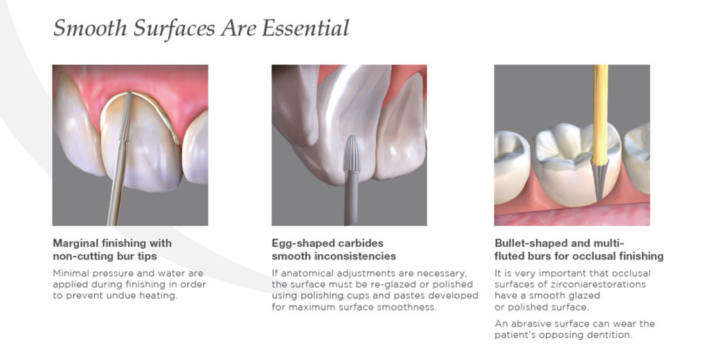 Zirlux Zirconia Finishing Guide UK United Kingdom