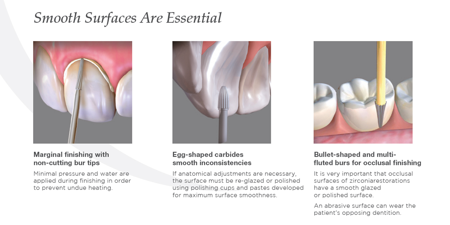 Zirlux Zirconia Finishing Guide UK United Kingdom